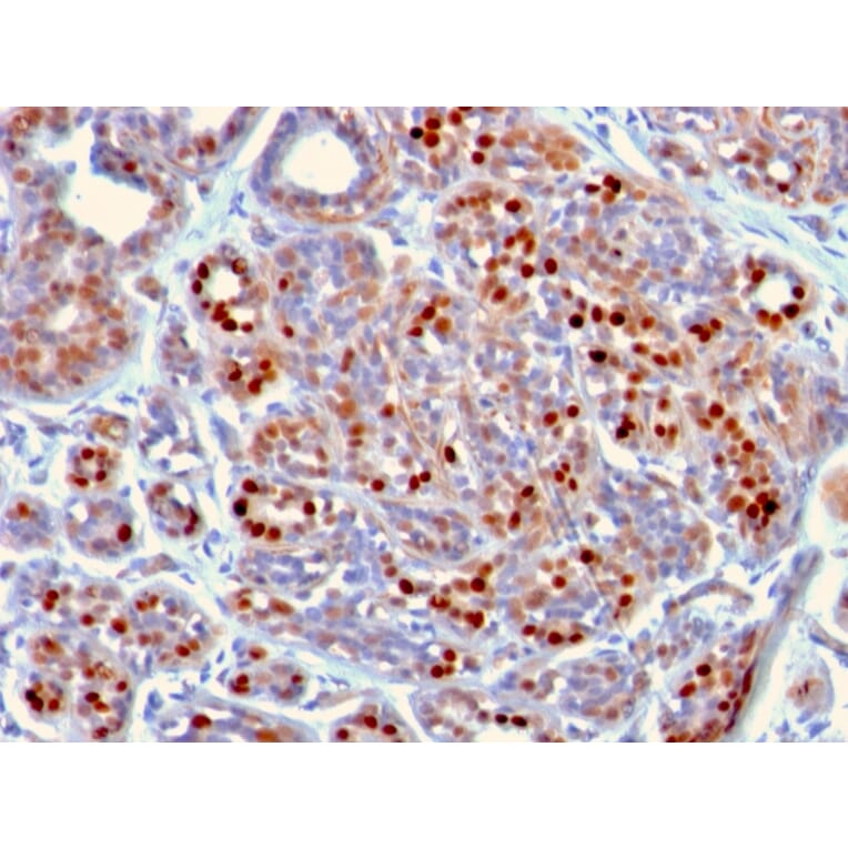 Immunohistochemistry - Anti-GATA3 Antibody [GATA3/2442] (A248695) - Antibodies.com