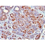 Immunohistochemistry - Anti-GATA3 Antibody [GATA3/2442] (A248695) - Antibodies.com
