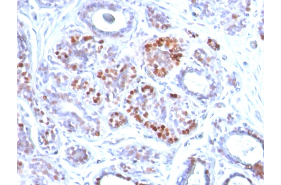 Immunohistochemistry - Anti-GATA3 Antibody [GATA3/2442] (A248694) - Antibodies.com