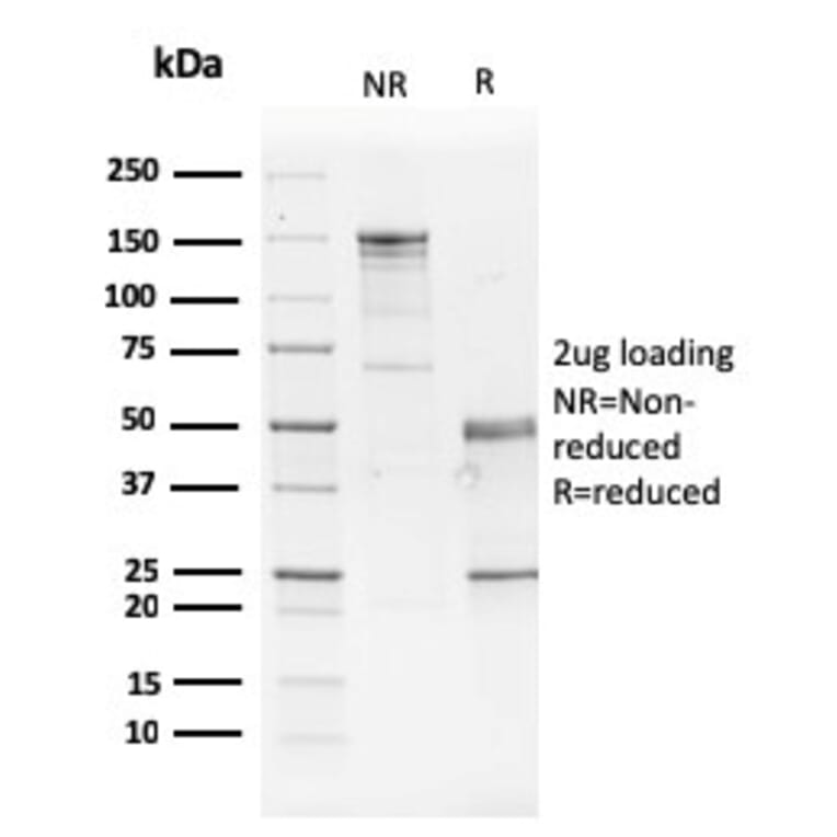 SDS-PAGE - Anti-GATA3 Antibody [GATA3/2442] (A248695) - Antibodies.com