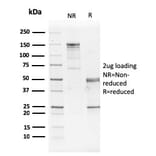 SDS-PAGE - Anti-GATA3 Antibody [GATA3/2442] (A248695) - Antibodies.com