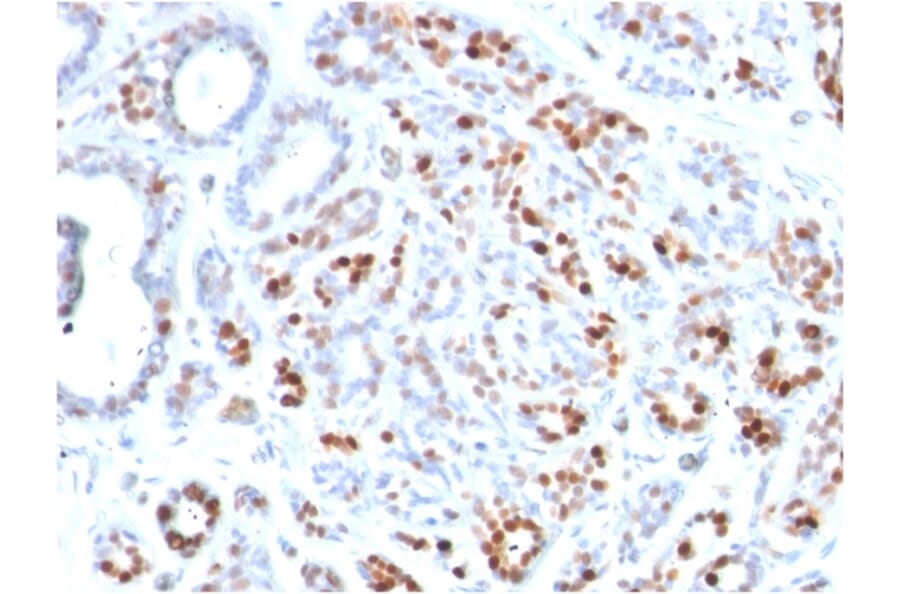 Immunohistochemistry - Anti-GATA3 Antibody [GATA3/2444] (A248696) - Antibodies.com