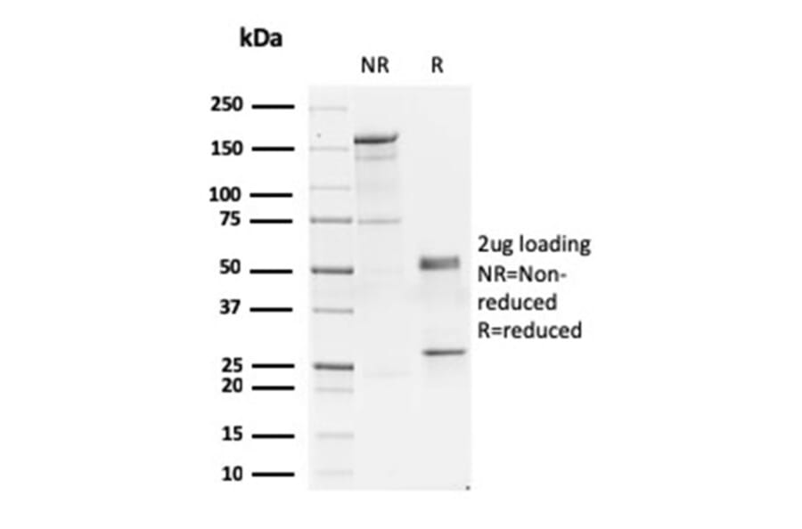 SDS-PAGE - Anti-GATA3 Antibody [GATA3/2445] (A248697) - Antibodies.com