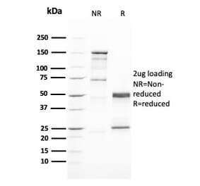 SDS-PAGE - Anti-GATA3 Antibody [GATA3/2446] (A248697) - Antibodies.com