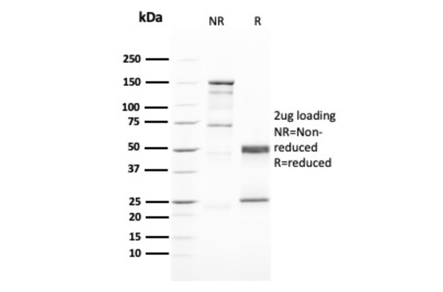 SDS-PAGE - Anti-GATA3 Antibody [GATA3/2446] (A248697) - Antibodies.com