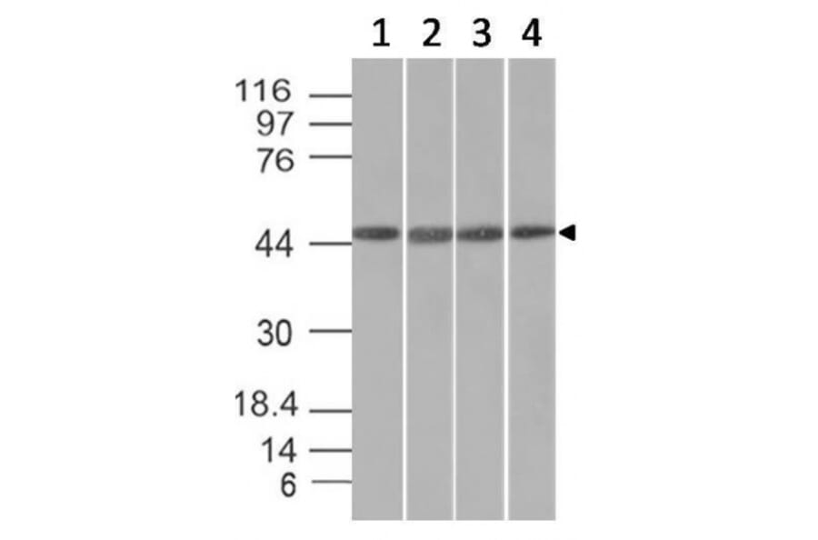 Western Blot - Anti-EMI1 Antibody [EMI1/1176] (A248700) - Antibodies.com