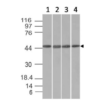 Western Blot - Anti-EMI1 Antibody [EMI1/1176] (A248700) - Antibodies.com