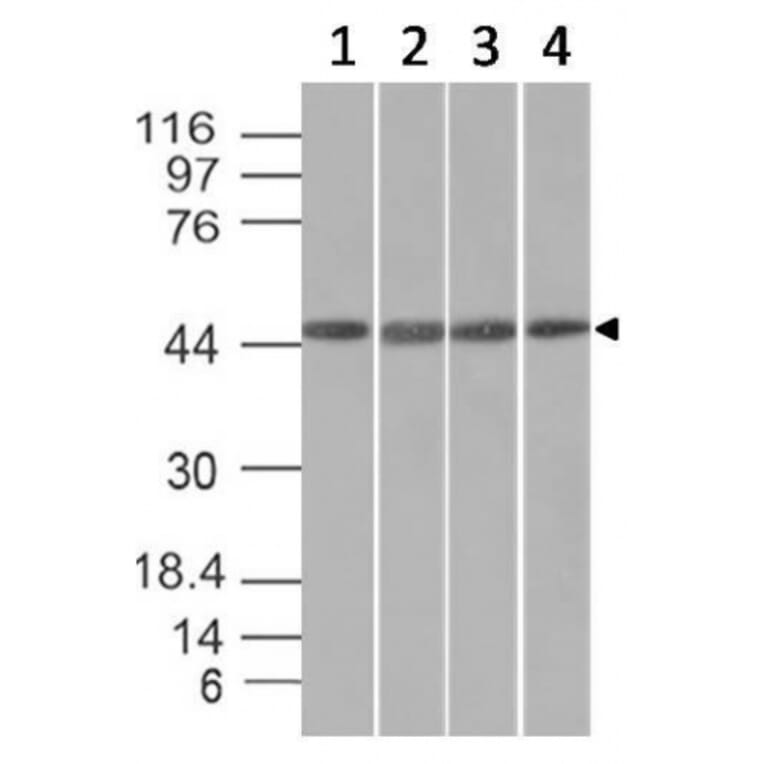 Western Blot - Anti-EMI1 Antibody [EMI1/1176] (A248700) - Antibodies.com