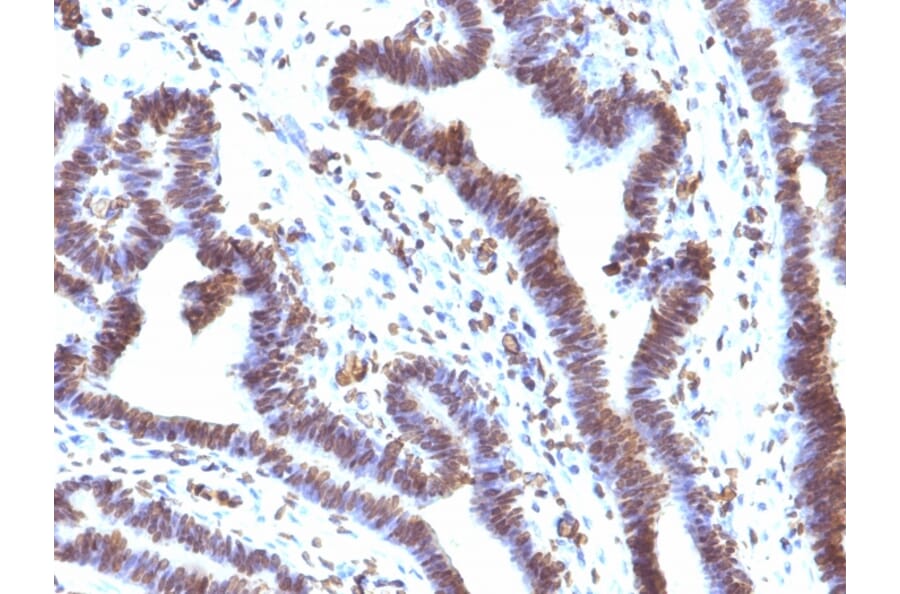 Immunohistochemistry - Anti-EMI1 Antibody [EMI1/1176] (A248700) - Antibodies.com