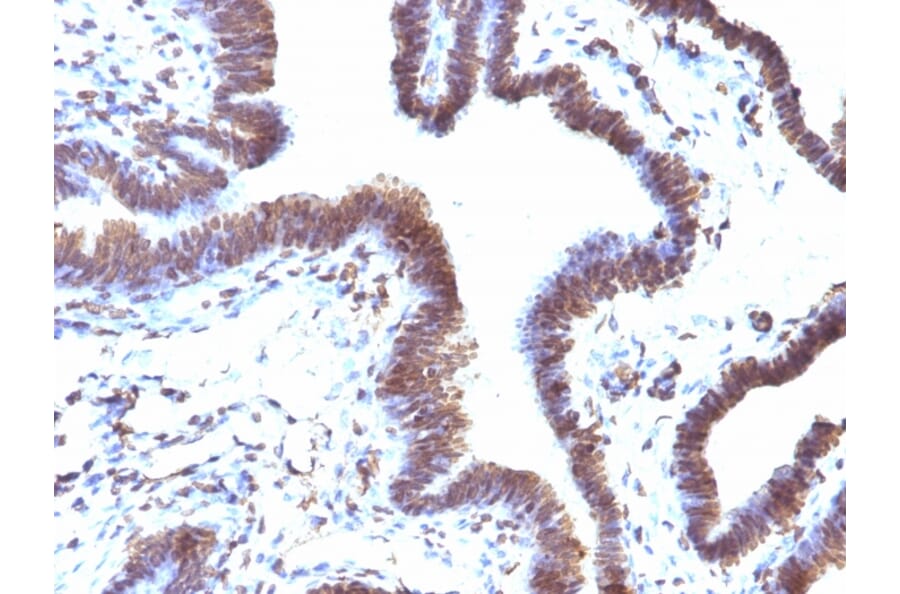 Immunohistochemistry - Anti-EMI1 Antibody [EMI1/1176] (A248700) - Antibodies.com