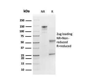 SDS-PAGE - Anti-FGF21 Antibody [FGF21/3691] (A248701) - Antibodies.com