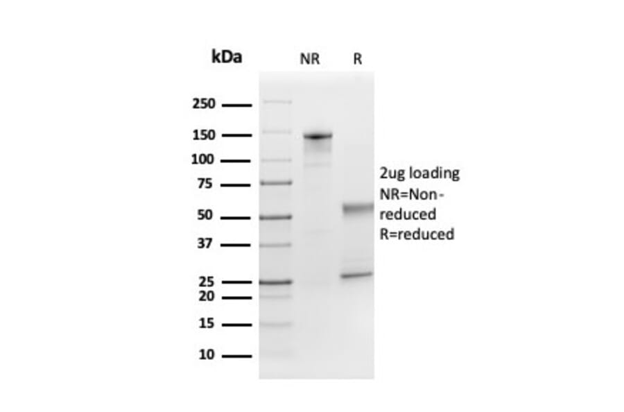 SDS-PAGE - Anti-FGF21 Antibody [FGF21/3691] (A248701) - Antibodies.com