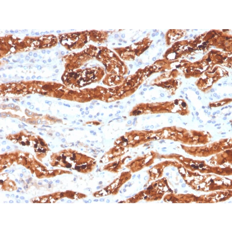 Immunohistochemistry - Anti-FGF21 Antibody [FGF21/3691] (A248701) - Antibodies.com