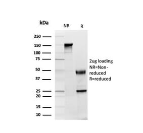 SDS-PAGE - Anti-GDF8 Antibody [GDF9/4261] (A248701) - Antibodies.com