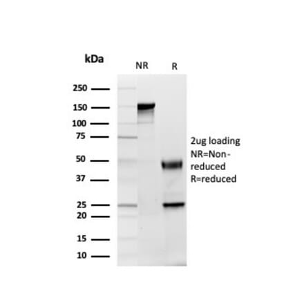 SDS-PAGE - Anti-GDF8 Antibody [GDF9/4261] (A248701) - Antibodies.com