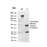 SDS-PAGE - Anti-GDF8 Antibody [GDF9/4261] (A248701) - Antibodies.com