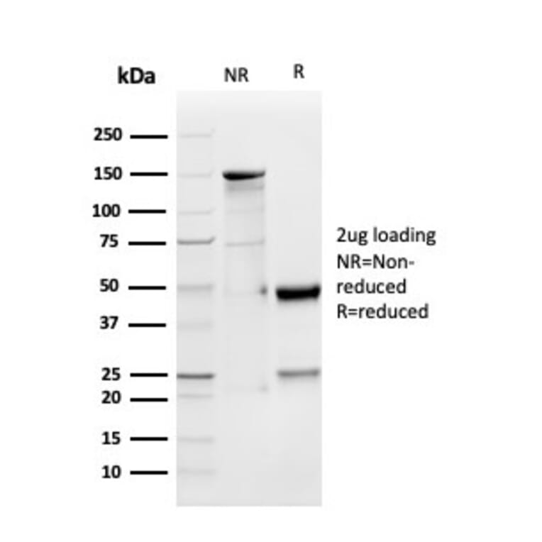 SDS-PAGE - Anti-GDF9 Antibody [GDF9/4261] (A248703) - Antibodies.com