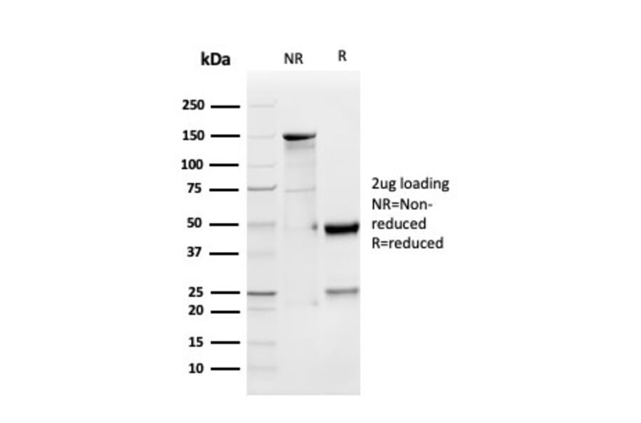 SDS-PAGE - Anti-GDF Antibody [GDF9/4262] (A251459) - Antibodies.com