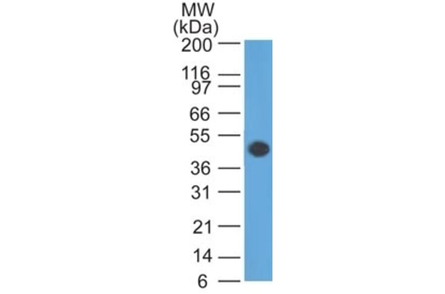 Western Blot - Anti-GFAP Antibody [GA-5] (A248705) - Antibodies.com
