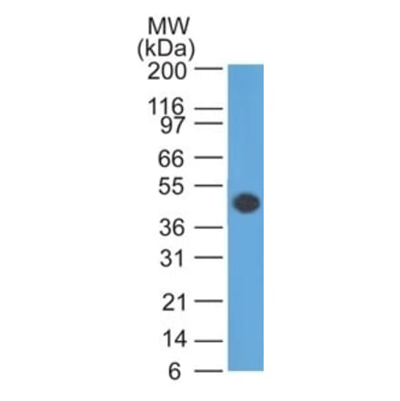 Western Blot - Anti-GFAP Antibody [GA-5] (A248705) - Antibodies.com