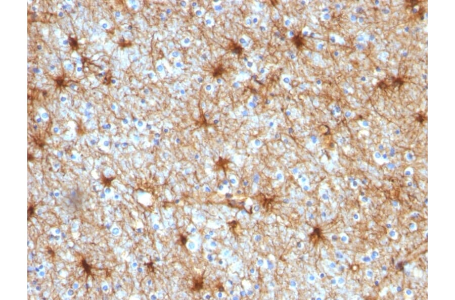 Immunohistochemistry - Anti-GFAP Antibody [GA-5] (A248705) - Antibodies.com