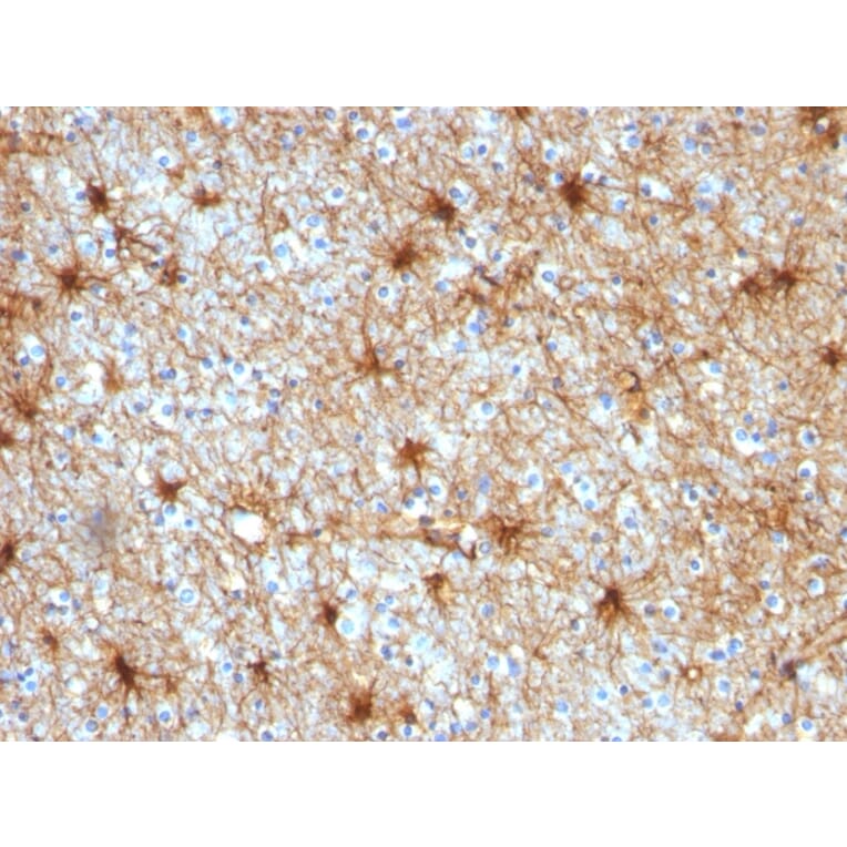 Immunohistochemistry - Anti-GFAP Antibody [GA-5] (A248705) - Antibodies.com