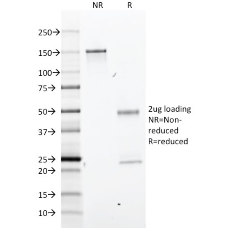 SDS-PAGE - Anti-GFAP Antibody [GA-5] (A248705) - Antibodies.com