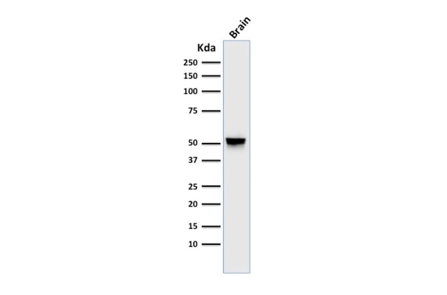 Western Blot - Anti-GFAP Antibody [GA-5] (A248705) - Antibodies.com