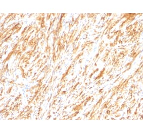 Immunohistochemistry - Anti-GFAP Antibody [SPM248] (A248706) - Antibodies.com