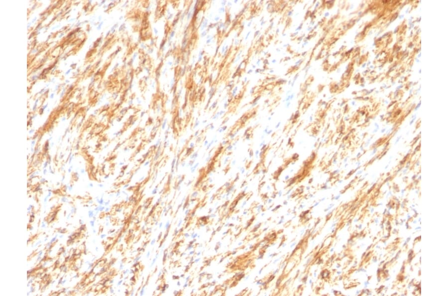 Immunohistochemistry - Anti-GFAP Antibody [SPM248] (A248706) - Antibodies.com