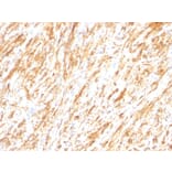 Immunohistochemistry - Anti-GFAP Antibody [SPM248] (A248706) - Antibodies.com