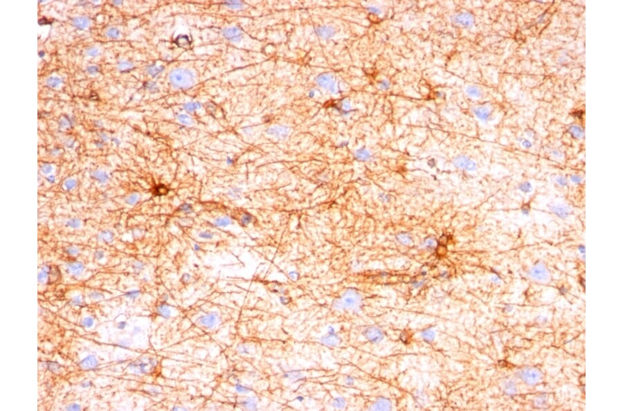 Immunohistochemistry - Anti-GFAP Antibody [SPM507] (A248706) - Antibodies.com