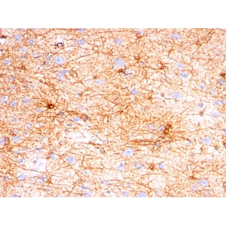 Immunohistochemistry - Anti-GFAP Antibody [SPM507] (A248706) - Antibodies.com