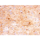 Immunohistochemistry - Anti-GFAP Antibody [SPM507] (A248706) - Antibodies.com