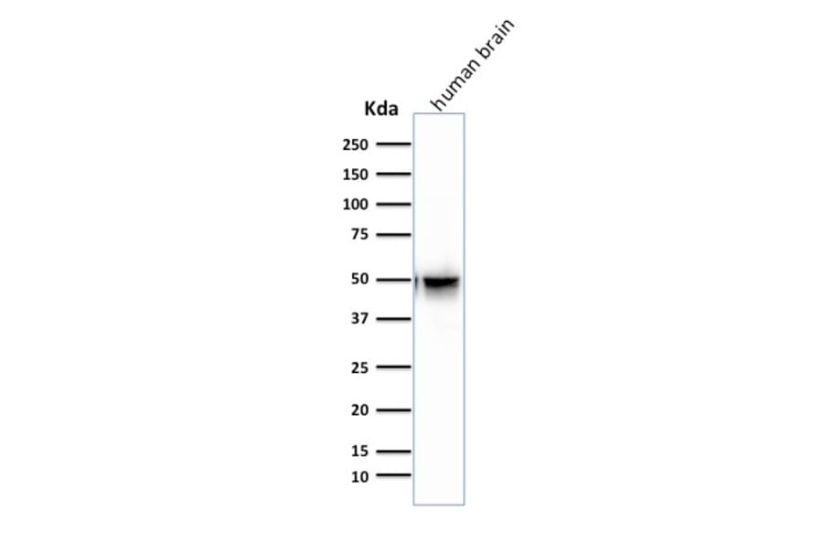 Western Blot - Anti-GFAP Antibody [SPM507] (A248707) - Antibodies.com