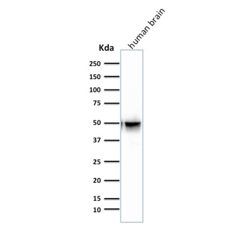 Western Blot - Anti-GFAP Antibody [SPM507] (A248707) - Antibodies.com