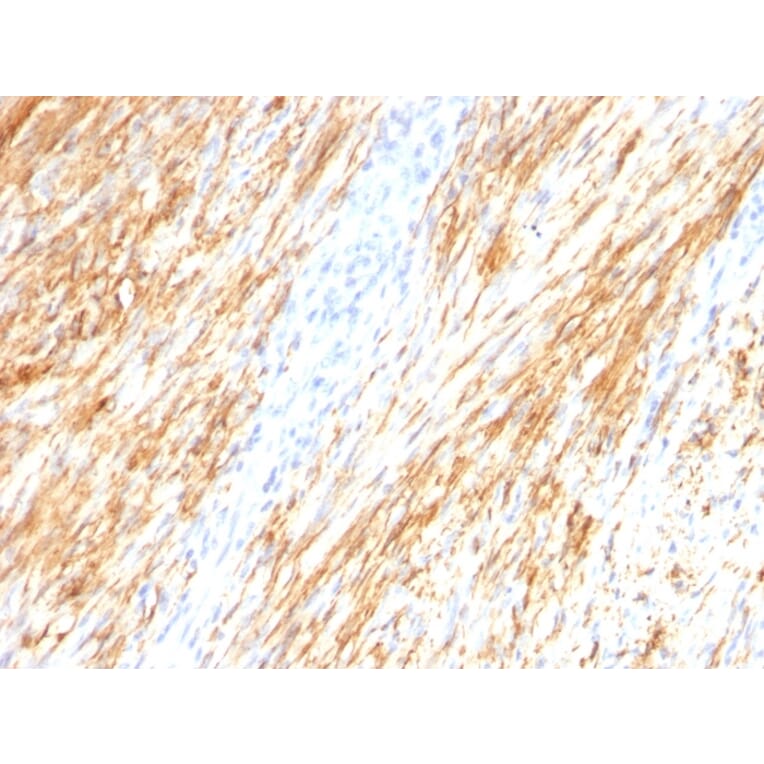 Immunohistochemistry - Anti-GFAP Antibody [ASTRO/789] (A248708) - Antibodies.com