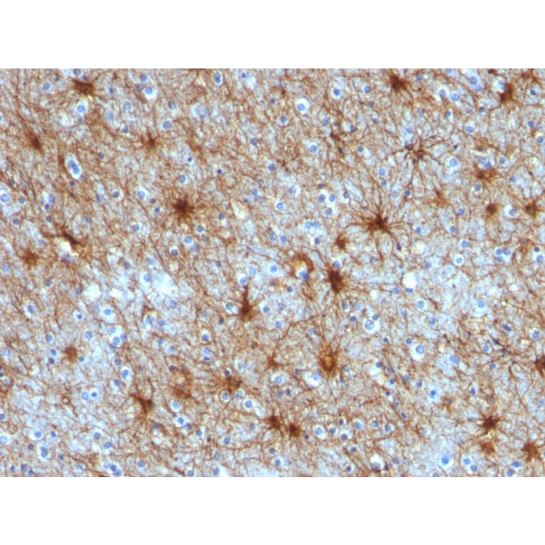 Immunohistochemistry - Anti-GFAP Antibody [ASTRO/789] (A248707) - Antibodies.com