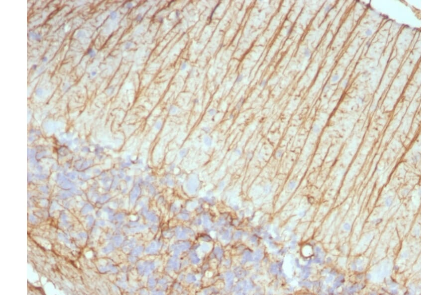 Immunohistochemistry - Anti-GFAP Antibody [ASTRO/789] (A248708) - Antibodies.com