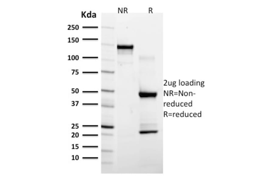 SDS-PAGE - Anti-GFAP Antibody [ASTRO/789] (A248708) - Antibodies.com