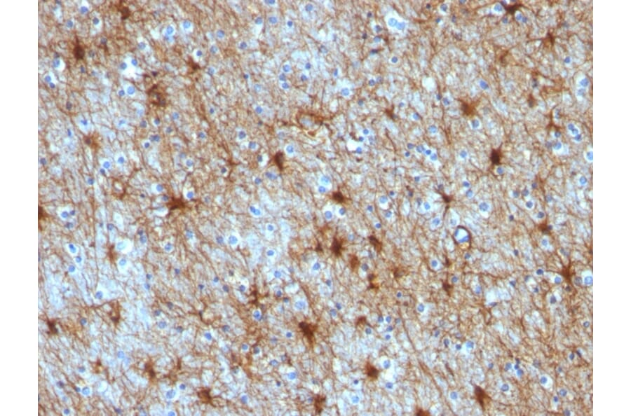 Immunohistochemistry - Anti-GFAP Antibody [GA-5 + ASTRO/789] (A248708) - Antibodies.com