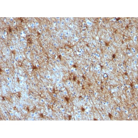 Immunohistochemistry - Anti-GFAP Antibody [GA-5 + ASTRO/789] (A248708) - Antibodies.com