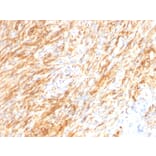 Immunohistochemistry - Anti-GFAP Antibody [GA-5 + ASTRO/789] (A248709) - Antibodies.com