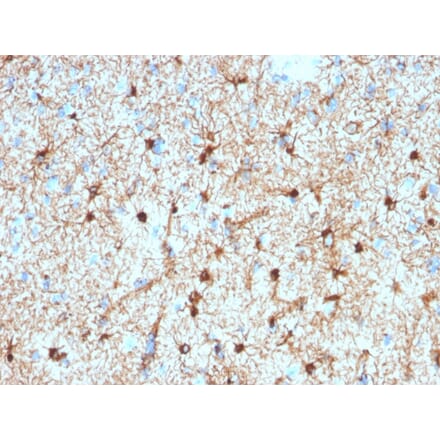 Immunohistochemistry - Anti-GFAP Antibody [GFAP/2076] (A248710) - Antibodies.com
