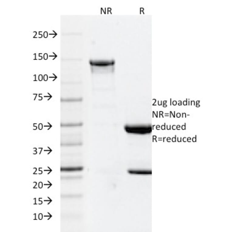 SDS-PAGE - Anti-GFAP Antibody [GFAP/2076] (A248710) - Antibodies.com
