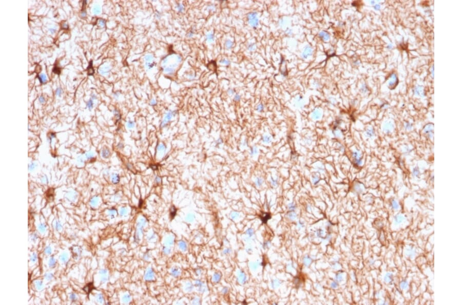 Immunohistochemistry - Anti-GFAP Antibody [rASTRO/789] (A248711) - Antibodies.com
