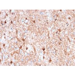 Immunohistochemistry - Anti-GFAP Antibody [rASTRO/789] (A248711) - Antibodies.com
