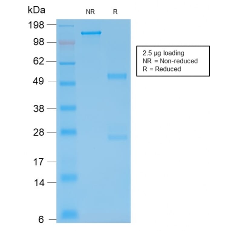 SDS-PAGE - Anti-GFAP Antibody [rASTRO/789] (A248711) - Antibodies.com