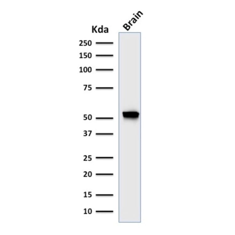 Western Blot - Anti-GFAP Antibody [rASTRO/789] (A248711) - Antibodies.com
