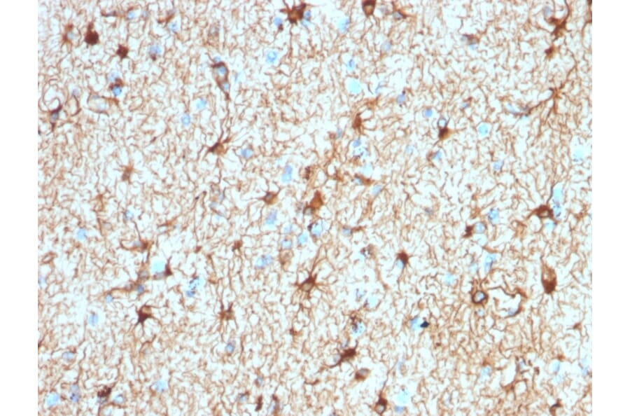 Immunohistochemistry - Anti-GFAP Antibody [ASTRO/1974R] (A248712) - Antibodies.com